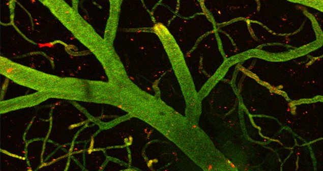 Caballos de Troya para vencer el Alzheimer